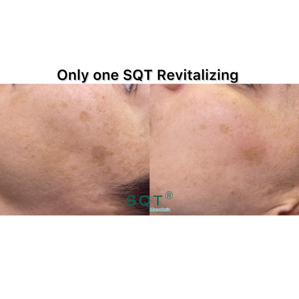 Verica Ravanoska SQT