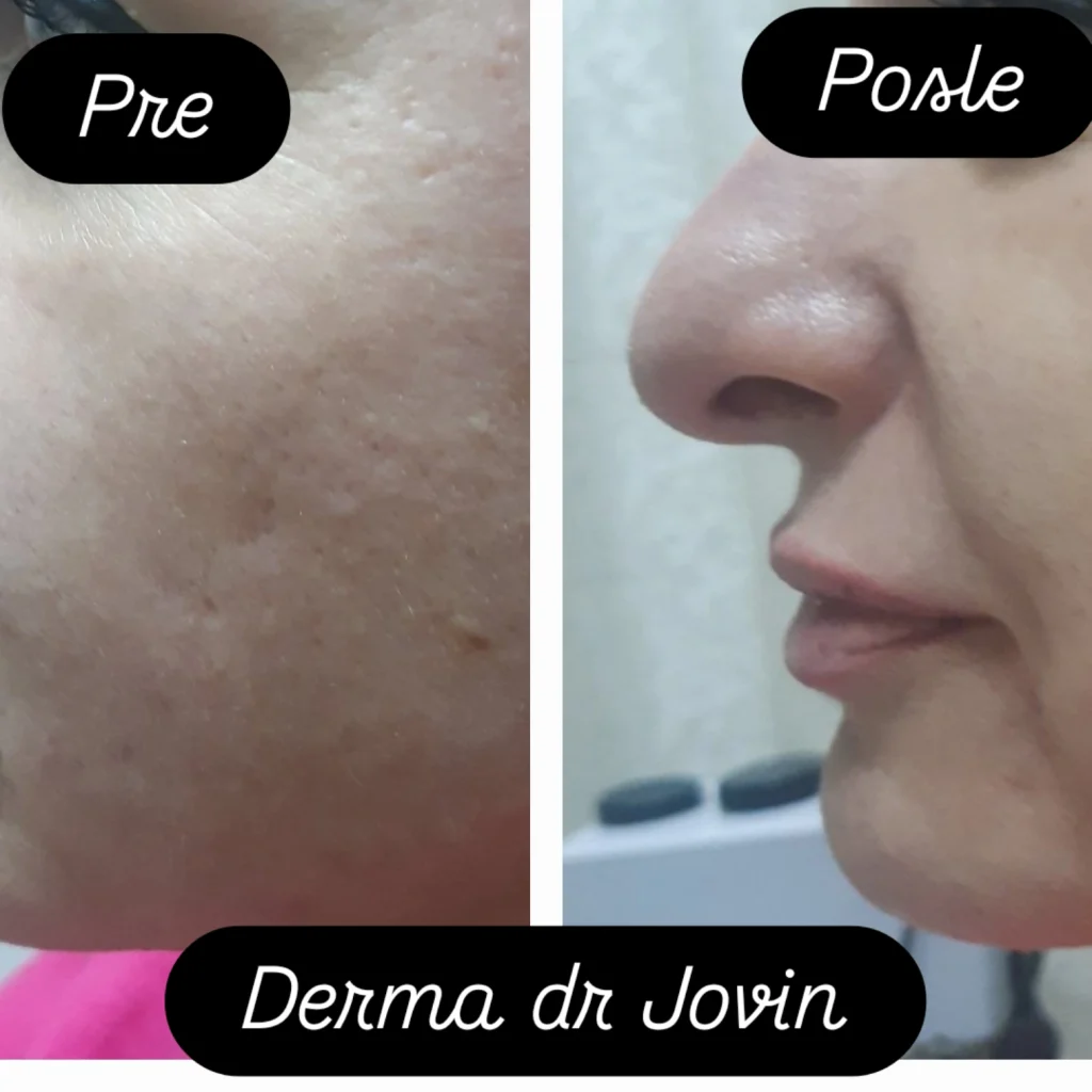 Img 20241129 073637 948